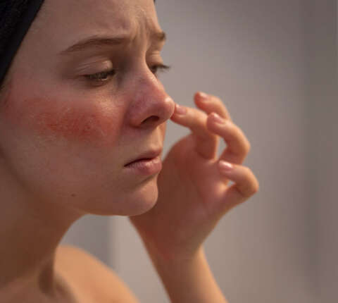 5 hábitos que dañan tu piel y no lo sabías